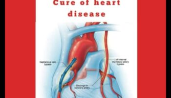 Cardiovascular Odyssey: Navigating the Seas of Heart Health